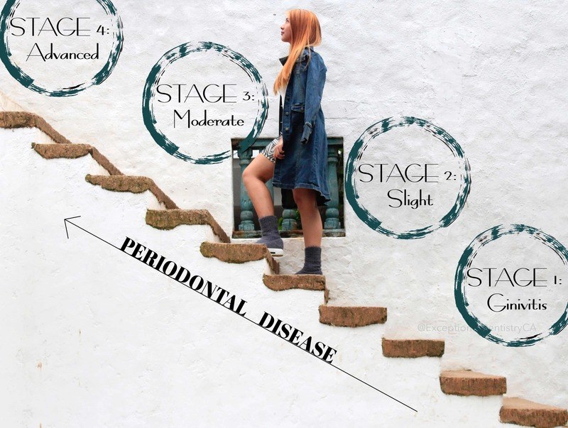 Periodontal Gum Chart